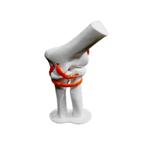 Medial anatomic elbow view