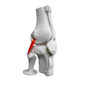 Lateral anatomic knee view